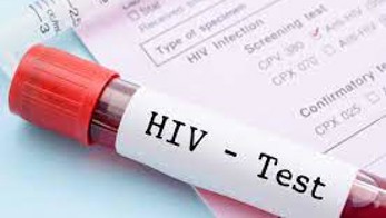 Вчасний тест на ВІЛ - врятує ваше життя!